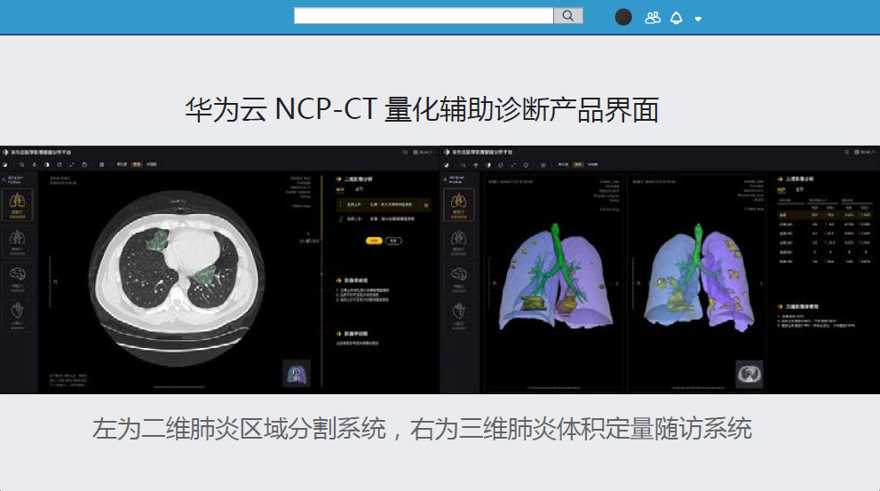 AI在医疗影像分析中的辅助作用_ai医学影像产品的主要价值有什么