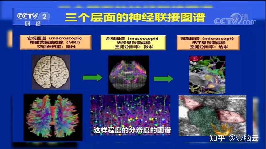 关于AI与脑机接口技术的协同发展​的信息