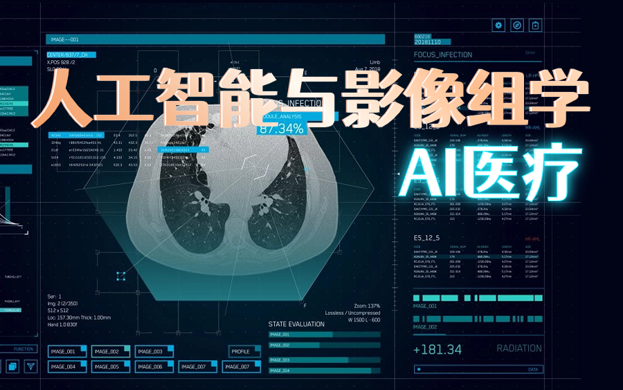 计算机视觉在智能医疗图像分割中的应用_计算机视觉在疫情中的作用