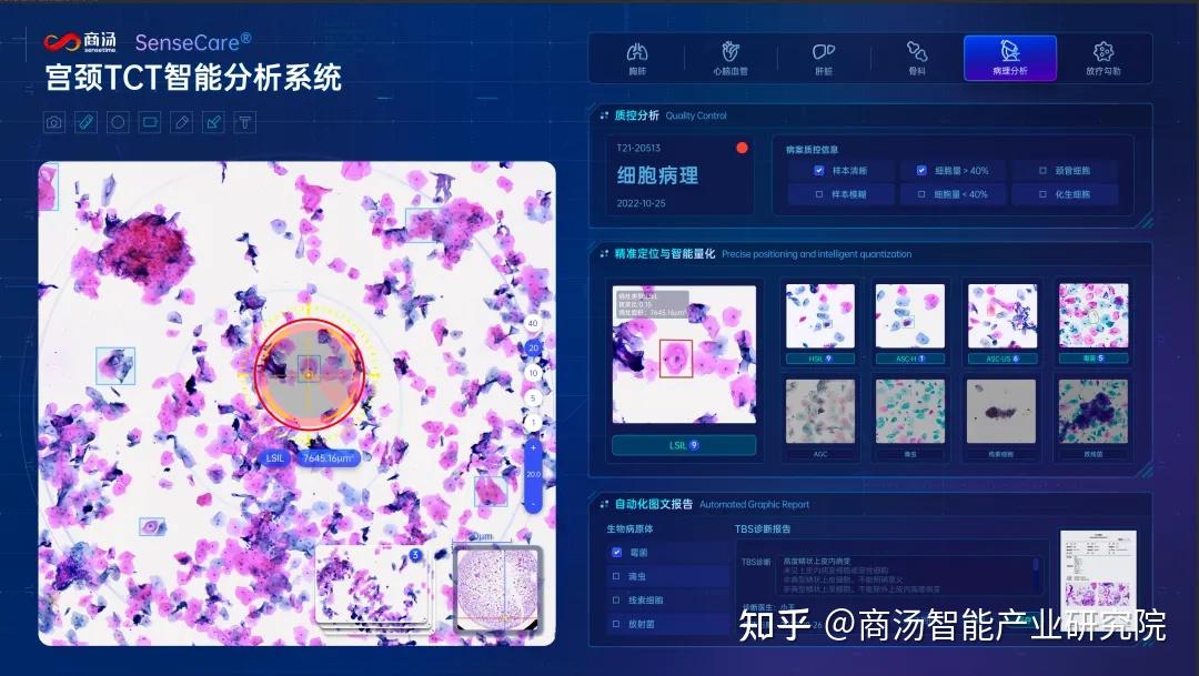计算机视觉在智能医疗图像分析中的应用_计算机视觉 医学