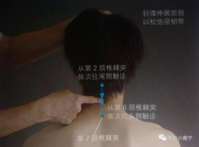 颈部转动机构的防抖与精准定位技术_转动颈部有什么好处
